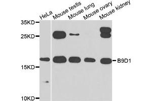 Western blot analysis of extracts of various cells, using B9D1 antibody. (B9D1 anticorps)