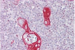 Immunohistochemistry with Thymus tissue at an antibody concentration of 5µg/ml using anti-FAIM antibody (ARP56237_P050)