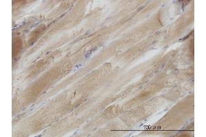 Immunoperoxidase of monoclonal antibody to SH3BGR on formalin-fixed paraffin-embedded human skeletal muscle. (SH3BGR anticorps  (AA 1-239))