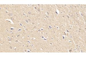 Detection of FAPa in Human Cerebrum Tissue using Monoclonal Antibody to Fibroblast Activation Protein Alpha (FAPa)