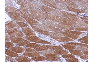 IHC-P Image Immunohistochemical analysis of paraffin-embedded mouse muscle, using CYP26A1 , antibody at 1:500 dilution.