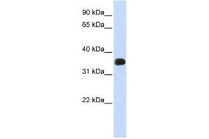 C2ORF47 antibody used at 1 ug/ml to detect target protein. (C2orf47 anticorps  (Middle Region))