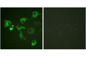 Immunofluorescence analysis of HuvEc cells, using eEF2 (Phospho-Thr56) Antibody. (EEF2 anticorps  (pThr56))