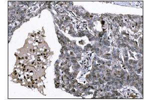 IHC analysis of KMT1B/SUV39H2 using anti-KMT1B/SUV39H2 antibody (ABIN7602135). (SUV39H2 anticorps  (AA 6-410))