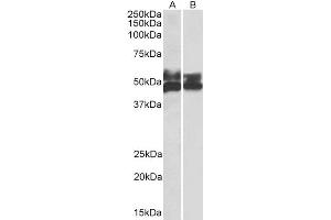 Western Blotting (WB) image for anti-Fc Receptor-Like 1 (FCRL1) antibody (ABIN5900721) (FCRL1 anticorps)