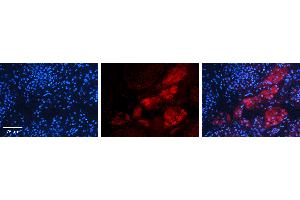 Rabbit Anti-KAT5 Antibody Catalog Number: ARP38792_P050 Formalin Fixed Paraffin Embedded Tissue: Human Testis Tissue Observed Staining: Cytoplasm in Leydig cells Primary Antibody Concentration: 1:100 Other Working Concentrations: N/A Secondary Antibody: Donkey anti-Rabbit-Cy3 Secondary Antibody Concentration: 1:200 Magnification: 20X Exposure Time: 0.