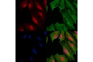 ABIN6259347 and ABIN6275551 staining  cells by IF/ICC. (PPP4R1L anticorps  (C-Term))