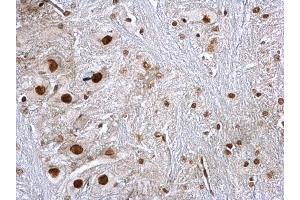 IHC-P Image hnRNP K antibody detects hnRNP K protein at nucleus on rat brain stem by immunohistochemical analysis.