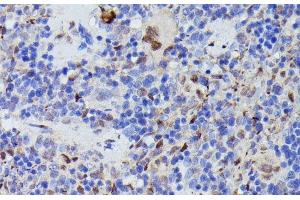 Immunohistochemistry of paraffin-embedded Rat spleen using CDC23 Polyclonal Antibody at dilution of 1:100 (40x lens). (CDC23 anticorps)