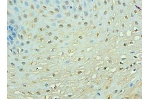 Immunohistochemistry of paraffin-embedded human esophageal tissue using  at dilution of 1: 100 (TEP1 anticorps  (AA 2-226))