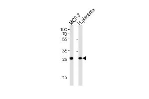 PRLR Antibody (Center) (ABIN1881684 and ABIN2843621) western blot analysis in MCF-7 cell line and human placenta tissue lysates (35 μg/lane). (Prolactin Receptor anticorps  (AA 147-179))