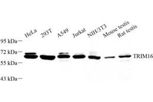 Western blot analysis of TRIM16 (ABIN7076012) at dilution of 1: 1000 (TRIM16 anticorps)