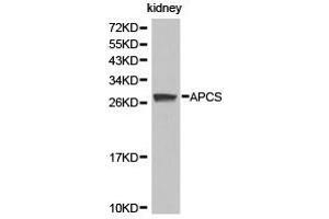 Western Blotting (WB) image for anti-Amyloid P Component, Serum (APCS) antibody (ABIN1871016) (APCS anticorps)