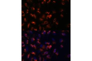 Immunofluorescence analysis of U-2 OS cells using STIM2 antibody (ABIN7270611) at dilution of 1:100.