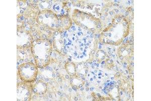 Immunohistochemistry of paraffin-embedded Mouse kidney using ASL Polyclonal Antibody at dilution of 1:100 (40x lens).