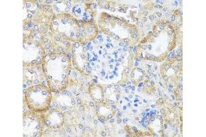 Immunohistochemistry of paraffin-embedded Mouse kidney using ASL Polyclonal Antibody at dilution of 1:100 (40x lens). (ASL anticorps)