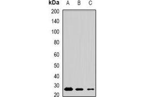 Western blot analysis of MSRB3 expression in mouse testis (A), mouse brain (B), rat lung (C) whole cell lysates. (MSRB3 anticorps)
