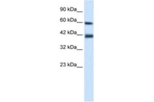 Western Blotting (WB) image for anti-Tripartite Motif Containing 31 (TRIM31) antibody (ABIN2461032) (TRIM31 anticorps)