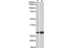 ABIN570906 (1µg/ml) staining of Mouse (A) and Rat (B) Skeletal Muscle lysate (35µg protein in RIPA buffer). (ATF5 anticorps  (C-Term))