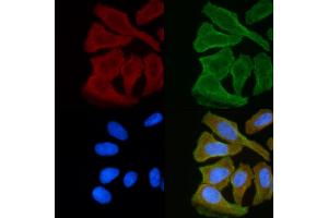 ABIN6255420 and ABIN6268978 staining Hela cells(30 min of UV treatment) by IF/ICC. (LCK anticorps  (pSer59))