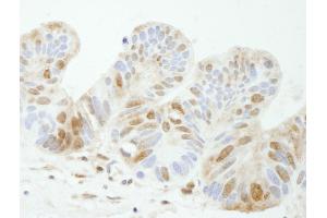 Immunohistochemistry (IHC) image for anti-Tyrosyl-DNA Phosphodiesterase 1 (TDP1) (AA 1-50) antibody (ABIN7448828) (TDP1 anticorps  (AA 1-50))