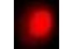 Immunofluorescent analysis of SNF2H staining in Hela cells.