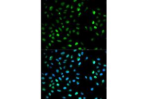 Immunofluorescence analysis of MCF7 cell using DTNBP1 antibody.