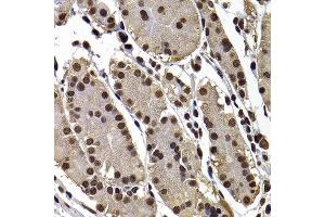 Immunohistochemistry of paraffin-embedded human stomach using GPS1 antibody at dilution of 1:100 (x400 lens). (GPS1 anticorps)