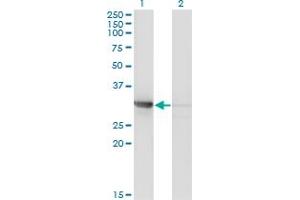 Western Blot analysis of CDK2 expression in transfected 293T cell line by CDK2 monoclonal antibody (M01A), clone 3A2-3G6. (CDK2 anticorps  (AA 1-298))
