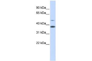 C2ORF25 antibody used at 1 ug/ml to detect target protein. (MMADHC anticorps  (Middle Region))