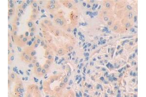 DAB staining on IHC-P; Samples: Human Kidney Tissue