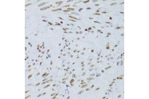 Immunohistochemistry of paraffin-embedded human uterus using NFKB2 Antibody.