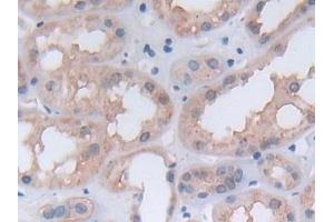Detection of PGK1 in Human Kidney Tissue using Polyclonal Antibody to Phosphoglycerate Kinase 1 (PGK1)
