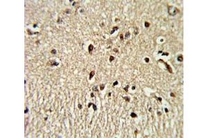 IHC analysis of FFPE human brain tissue stained with PAX4 antibody (PAX4 anticorps  (AA 171-200))