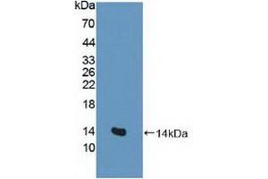 Figure. (SLC1A1 anticorps  (AA 115-209))