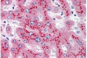 Human Liver (formalin-fixed, paraffin-embedded) stained with SAA1 antibody ABIN305737 at 5 ug/ml followed by biotinylated anti-mouse IgG secondary antibody ABIN481714, alkaline phosphatase-streptavidin and chromogen. (SAA1 anticorps)