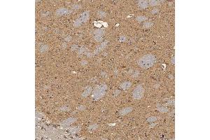 IHC analysis of SEC31A using anti-SEC31A antibody (ABIN7599630).