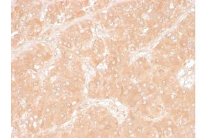 Formalin-fixed, paraffin-embedded human Adrenal stained with Adipophilin Mouse Monoclonal Antibody (ADFP/1366). (ADRP anticorps  (AA 249-376))