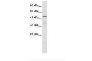 Image no. 1 for anti-Zinc Finger Protein 358 (ZNF358) (AA 104-153) antibody (ABIN202633)