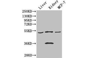 Western Blot Positive WB detected in: Mouse liver tissue, Mouse kidney tissue, MCF-7 whole cell lysate All lanes: CDSN antibody at 3 μg/mL Secondary Goat polyclonal to rabbit IgG at 1/50000 dilution Predicted band size: 52 kDa Observed band size: 52, 36 kDa (Corneodesmosin anticorps  (AA 40-229))