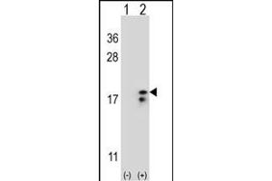 Western blot analysis of COX6A1 (arrow) using rabbit polyclonal COX6A1 Antibody (Center) (ABIN653100 and ABIN2842691).