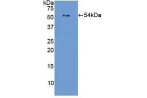 Detection of Recombinant FLG, Mouse using Polyclonal Antibody to Filaggrin (FLG) (Filaggrin anticorps  (AA 119-336))