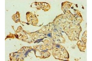 Immunohistochemistry of paraffin-embedded human placenta tissue using ABIN7145118 at dilution of 1:100 (ATG9B anticorps  (AA 715-924))