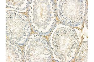 ABIN7094477 and ABIN7098525 at 1/100 staining Rat testis tissue by IHC-P.