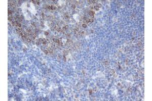 Image no. 1 for anti-SERPINE1 mRNA Binding Protein 1 (SERBP1) (AA 1-262) antibody (ABIN1490678)