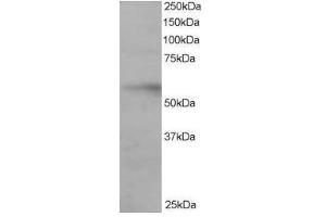 Image no. 1 for anti-Interferon Regulatory Factor 6 (IRF6) (C-Term) antibody (ABIN374199) (IRF6 anticorps  (C-Term))