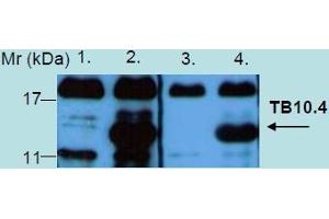 Western Blotting analysis of recombinant protein TB10. (Tb 10.4 anticorps)
