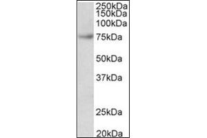 FUBP1 Antibody Cat. (FUBP1 anticorps  (Internal Region))