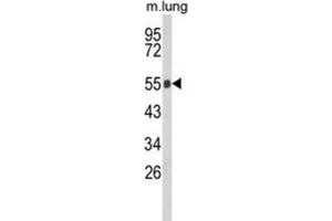 Western Blotting (WB) image for anti-Gc antibody (ABIN3003972) (Gc anticorps)
