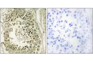 Immunohistochemistry analysis of paraffin-embedded human testis tissue, using HGS Antibody. (HGS anticorps  (AA 451-500))